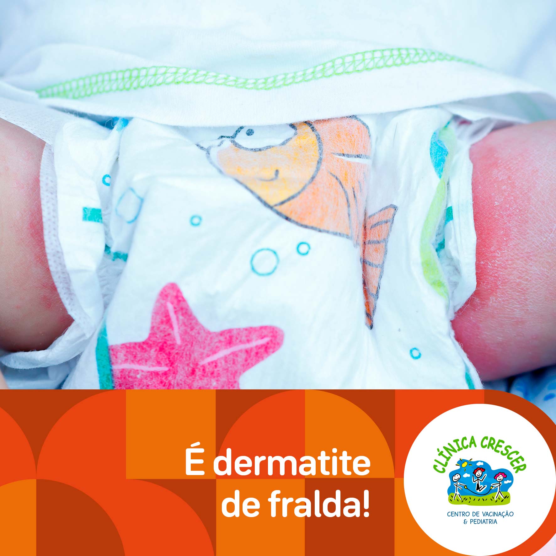 CRESCER_dermatite(WEB)