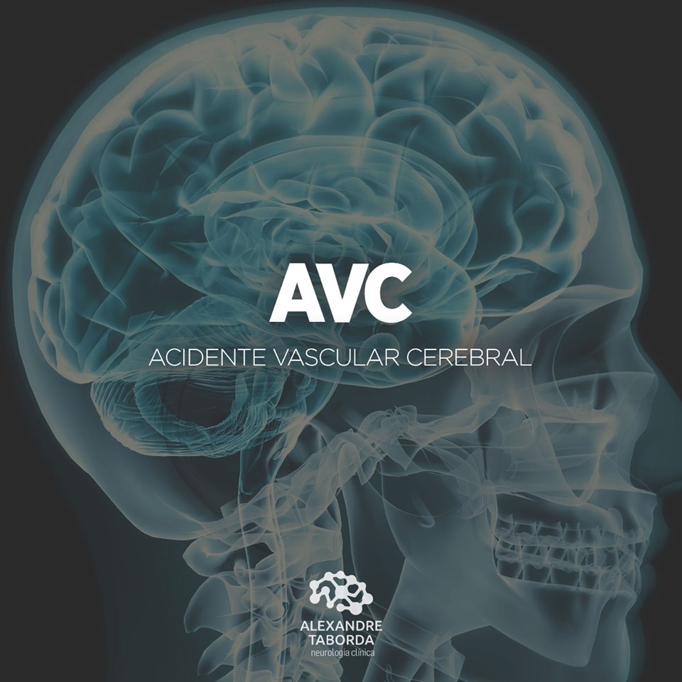 AVC