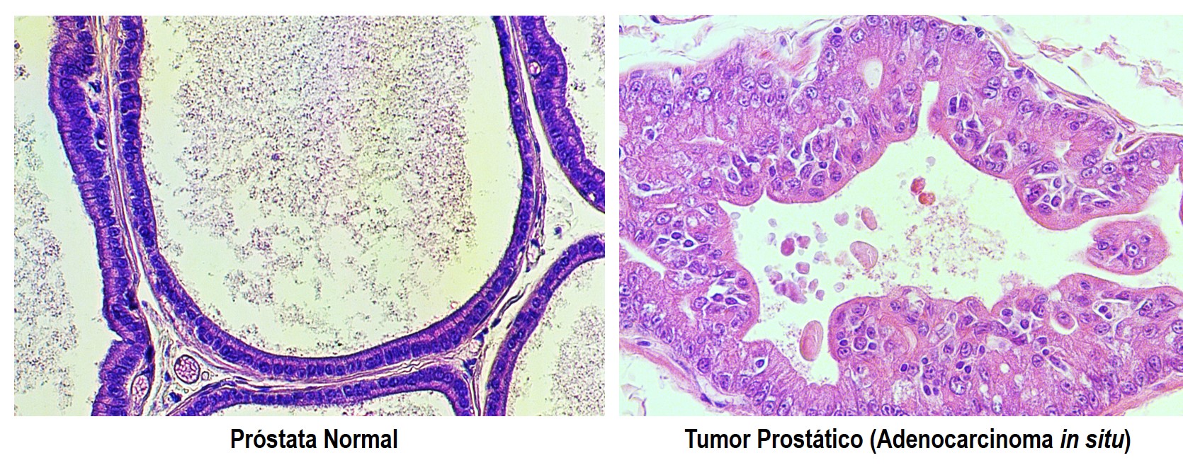 PESQUISA-FTALATO-CANCER-DE-PROSTATA-WELLERSON-SCARANO-IBBUNESP PESQUISA-FTALATO-CANCER-DE-PROSTATA-WELLERSON-SCARANO-IBBUNESP