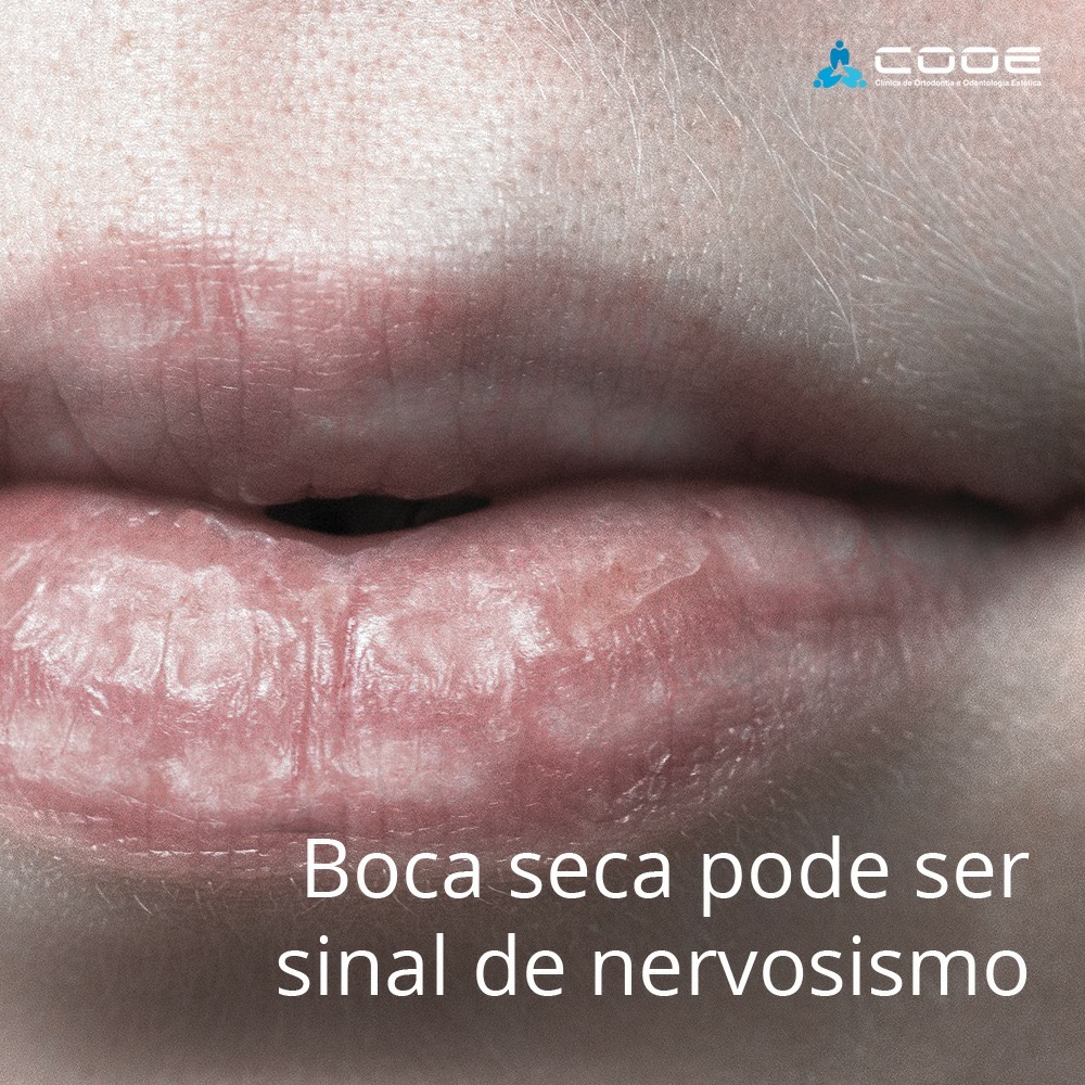 dicas boca seca