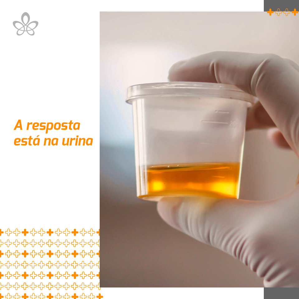 Preposição Preposição