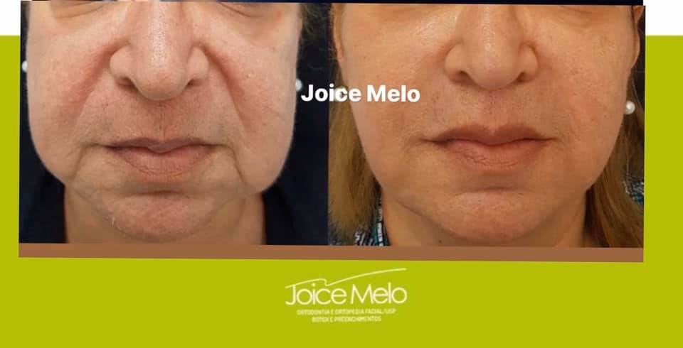 Com o passar dos anos