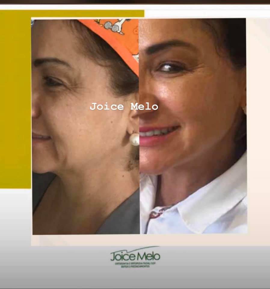 faço em min tambem 111