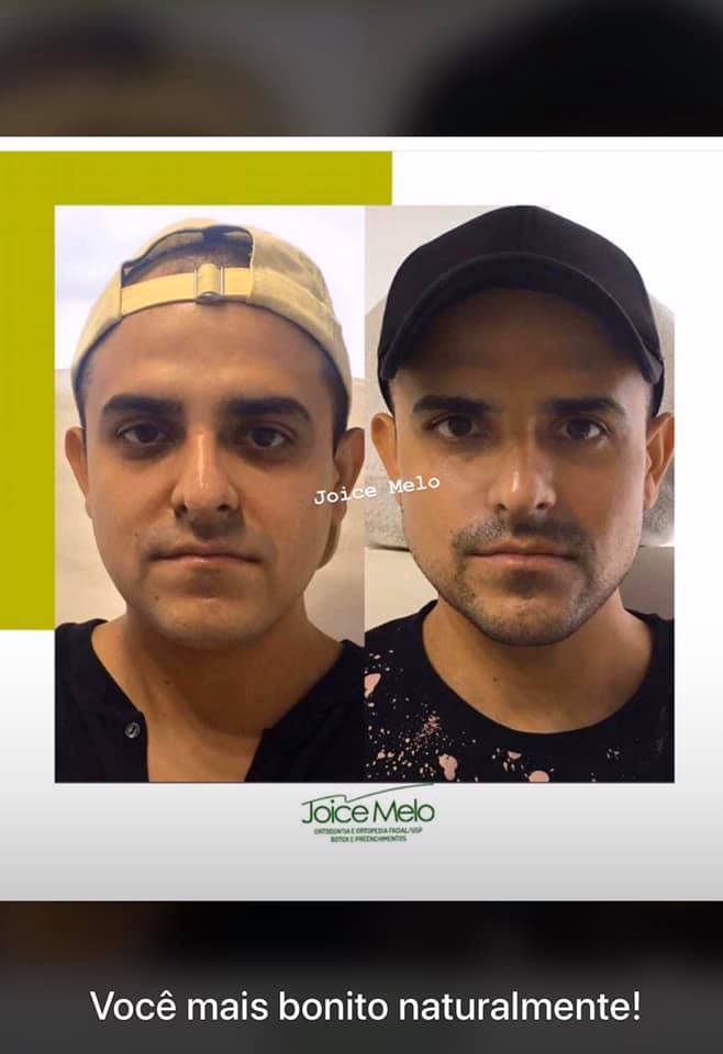 voce mais bonita naturalmente