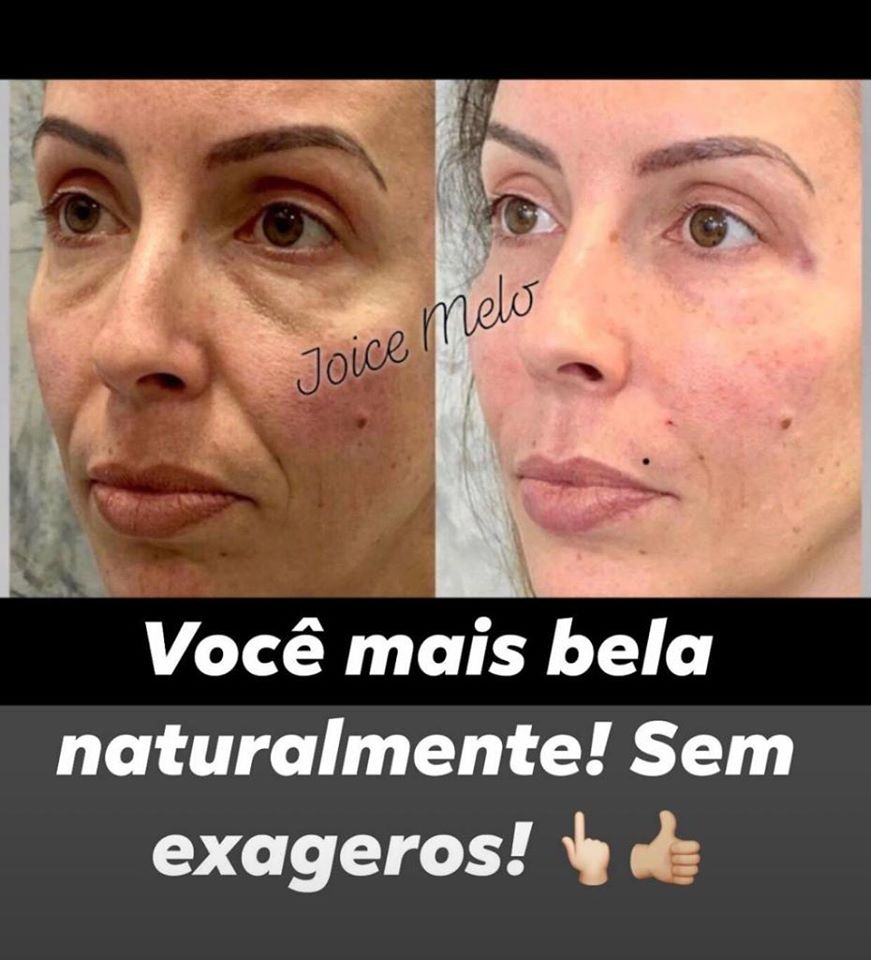voce mais bonita naturalmente