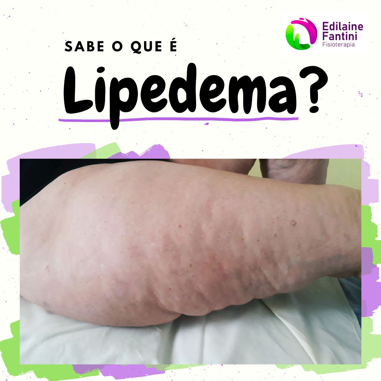 epidema epidema