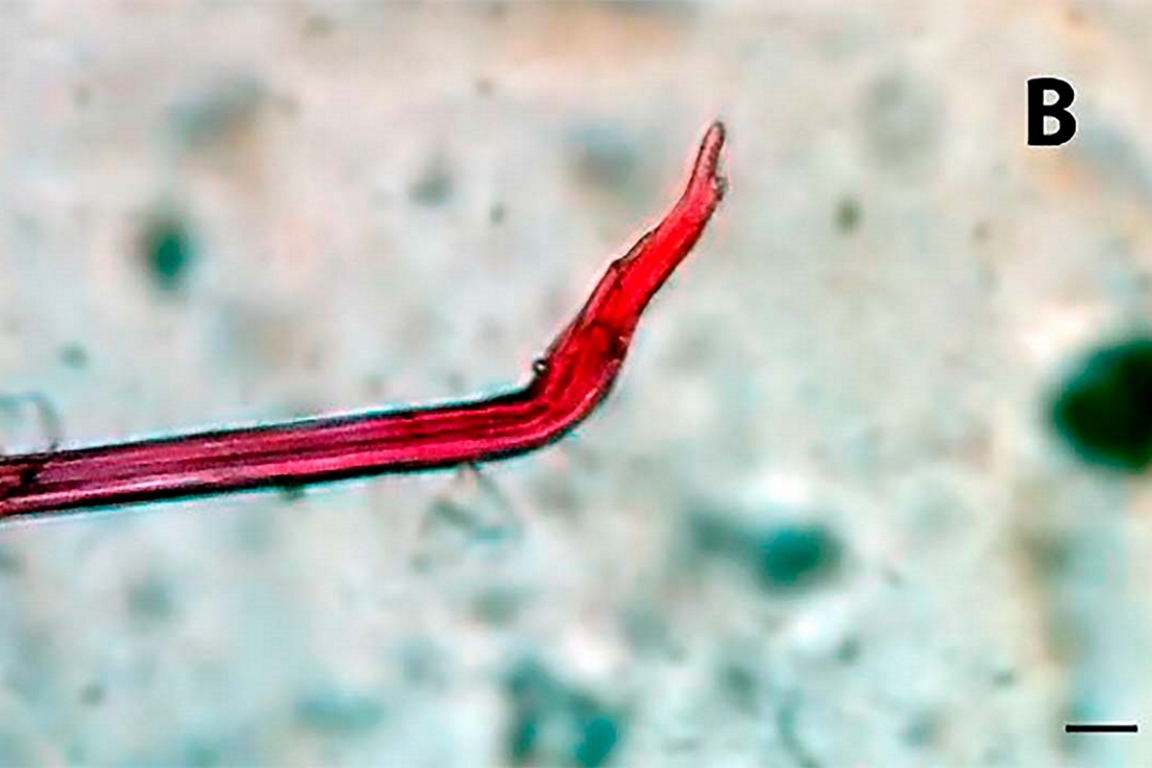 microplasticoB microplasticoB